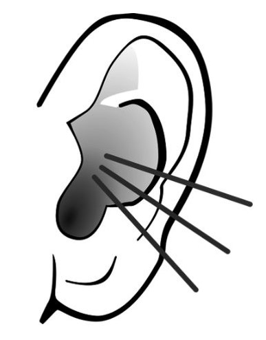 Drawing of an ear showing 3 protruding lines extending outward.